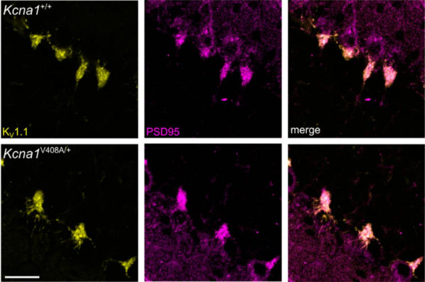 Representative confocal sections of lamina adjacent to the Purkinje cell layer from Kcna1V408A/+ and control cerebellar cortex, labelled for KV1.1 (Cat.75-105, 1:1000;  yellow) and PSD-95 (centre, magenta). Right, merged image. Image from publication CC-BY-4.0. PMID: 37408217