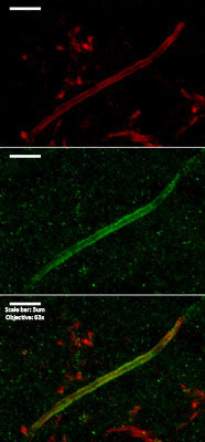 Immunolabeling of postnatal 14 mouse CA1 (Axonal Initial Segment, Interneuron) specifically labeling extracellular Kv1.1 (Cat no 75-105, 1:200, green) and Ankyrin G (red). DNA labeled with DAPI. Mice transcardially perfused with cold 4% PFA in PBS, brain removed and postfixed overnight. 50 uM slices as floating sections, antigen retrieval performed with sodium citrate at 80 C for 30 min before immunolabeling. Images from: J. Ramirez-Franco and O. El Far, Aix-Marseille Université and INSERM. 