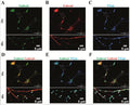 The distribution of both α1 (Cat. 75-136, 1:1000; green) and α6 (red) subunits was investigated on the cerebellar granule cells. Both subunits were each co-stained with the