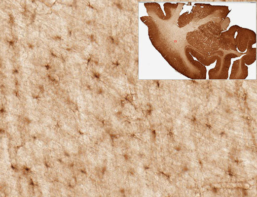 Immunohistochemistry (IHC) staining of Rhesus macaque brain for astrocyte marker Aldh1L1 using Anti-Aldh1L1 Antibody 75-140 (clone N103/39, 1:3000). Tissue was perfusion fixed with 4% paraformaldehyde and 0.1% glutaraldehyde, then drop-fixed in 4% paraformaldehyde for 24 h. Sections were cut in 60 μm thick coronal sections using a vibrating microtome. Image courtesy of Adriana Galvan (Emory University). Additional experimental details can be found at: pubmed.ncbi.nlm.nih.gov/35202614.