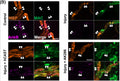 Nerve-muscle preparations from Glial or hCAST × Glial mice were treated acutely ex vivo with anti-GM1 Ab alone (Control) or with a source of complement (Injury) in the presence or absence of exogenous calpain inhibitor AK295. Representative images demonstrate nodal protein localization coinciding with complement deposition (green). AnkyrinB (AnkB) immunostaining (Cat. 75-145, 1:300; magenta) was reduced compared to control for each treatment. Image from publication CC-BY-4.0. PMID:36710500