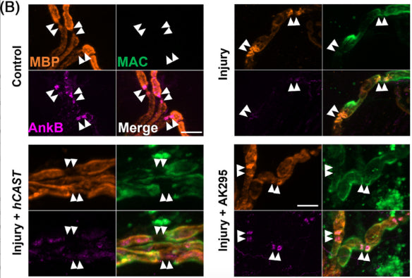 Nerve-muscle preparations from Glial or hCAST × Glial mice were treated acutely ex vivo with anti-GM1 Ab alone (Control) or with a source of complement (Injury) in the presence or absence of exogenous calpain inhibitor AK295. Representative images demonstrate nodal protein localization coinciding with complement deposition (green). AnkyrinB (AnkB) immunostaining (cat. 75-145, 1:300; magenta) was reduced compared to control for each treatment. Image from publication CC-BY-4.0. PMID:36710500