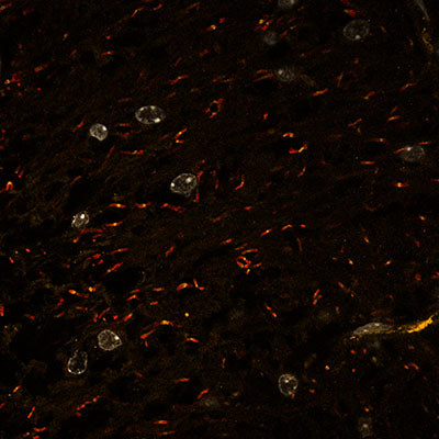 Immunostaining of mouse sliced optic nerve labeling Ankyrin G(Cat no 75-146, orange, 1:125) and Caspr (red). Nuclei are stained with DAPI.  Image was taken at the CRL Molecular Imaging Center, RRID:SCR_017852, supported by the Helen Wills Neuroscience Institute. Image kindly provided by Anna Elleman, UC Berkley.