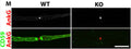 Immunofluorescence labeling of WT (left panels) and CD59 KO mouse(right panels) teased fibers show normal node structure by CD59 (green) and AnkG (Cat. 75.146; red). Image from publication CC-BY-4.0. PMID:37875972