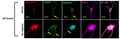 Representative images showed the high expression level of FKBP12 (green) in axonal hillock/axon initial segment (labeled by anti–ankyrin-G antibody, cat. 75-147; bright blue) under basal conditions whereas FKBP12 translocated to soma and dendrites when neurons bear tau aggregation. Image from publication