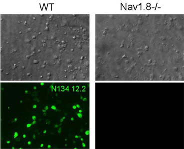 Immunofluorescence staining of cultured dorsal root ganglia neurons from Nav1.8 WT and KO mice with N134/12 TC supe. Image courtesy of Dr. Joel Black, Dr. Sulayman Dib-Hajj and Dr. Steve Waxman, Yale University.