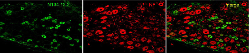 Immunofluorescence staining of rat dorsal root ganglia cryosections. N134/12 TC supe = green, neurofilament = red. Image courtesy of Dr. Joel Black, Dr. Sulayman Dib-Hajj and Dr. Steve Waxman, Yale University.