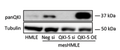 Western blot image of human mammary epithelial (HMLE) cells and TGF-beta treated HMLE (mesHMLE) cells that were treated with QKI-5 siRNA knockdown labeled with Anti-pan-QKI (Cat. 75-168, 1:1000). Image from publication, CC-BY-4.0. PMID: 38112323.