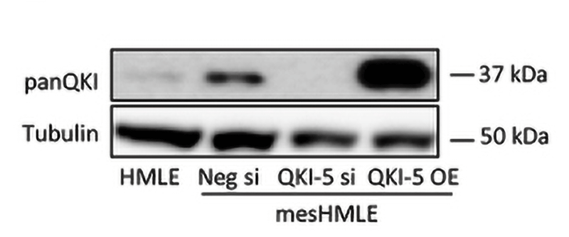 Western blot image of human mammary epithelial (HMLE) cells and TGF-beta treated HMLE (mesHMLE) cells that were treated with QKI-5 siRNA knockdown labeled with Anti-pan-QKI (cat no 75-168, 1:1000). Image from publication, CC-BY-4.0. PMID:  38112323.