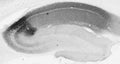 Adult rat hippocampus immunohistochemistry.