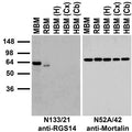 Immunoblot against crude membranes from whole mouse (MBM) or rat (RBM) brain and from human hippocampus [HBM(H)], cerebral cortex [HBM(Cx)] or cerebellum [HBM(Cb)] probed with N133/21 (left) or N52A/42 (right) TC supe.
