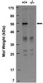 Immunoblot against lysates from wild-type (+/+) and RGS14 knockout (-/-) mouse brains probed with N133/21. Data courtesy of John Hepler (Emory).