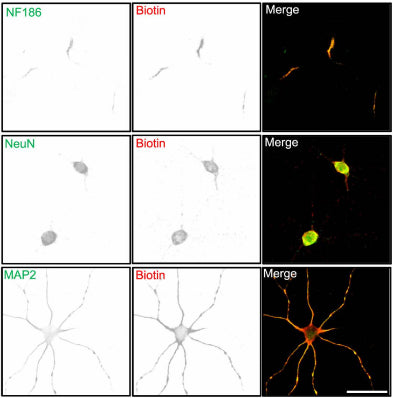 Biotinylated proteins colocalize with endogenous protein signals in the axon initial segment, soma, and somatodendrites. The proximity labeling was directed by anti-NFASC (cat. 75-172, 1:1000), anti-NeuN, and anti-MAP2 antibodies individually in DIV14 rat cortical neurons with one minute of reaction time. Image from publication CC-BY-4.0. PMID:38081810