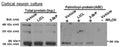 Lysates of rat cortical neurons treated with the indicated compounds were subjected to ABE to purify palmitoylated proteins. Levels of palmitoyl-AnkG-190 (right blot) and total AnkG (Cat. 75-187) expression in parent lysates (left blot bottom blot) were detected with specific antibodies. Exclusion of NH2OH was used as a
