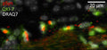Double immunofluorescence revealing pruned Lewy Neurites (pSyn, Red) and the cytoplasms of mature mouse OLs (QKI-7, cat. 75-200, 1:500; green) at the level of the anterior commissure of a mouse 6 months after the intrastriatal injection of α-Syn