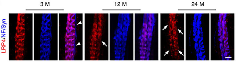 Representative images of EDL muscles of 3 M, 12 M, and 24 M-old mice, whole mount stained with 555-anti-LRP4 (Cat no 75-221, 1:200, red) and NF/Syn (blue). Arrowheads, non-annulospiral axons had no LRP4 expression. Arrows, LRP4 negative annulospiral endings in aged mice. Scale bar, 10 µm. Image from publication CC-BY-4.0. PMID:36765071