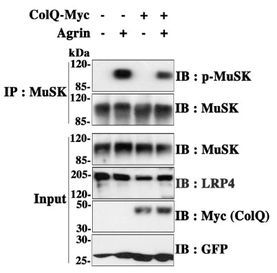 Rat ColQ−/− muscle cells were transduced to express ColQ-Myc (+) or not (−). After differentiation, the myotubes were treated (+) or not (−) with 10 nM of neural agrin for 1 h, and MuSK tyrosine phosphorylation was assessed as aforementioned. E, MuSK and LRP4 (cat. 75-221, 1:1000) cs levels of ColQ−/− myotubes re-expressing ColQ-Myc (+) or not (−) and not treated with agrin were analyzed. Image from publication CC-BY-4.0. PMID:37356721