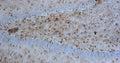 Immunohistochemistry for detection of GFAP in rat hippocampus using anti-GFAP antibody clone N206A/8 (Cat. 75-240) and Streptavidin/Biotin-ABC-Peroxidase Staining Kit (Cat. IH-8106). Tissue was fixed with 4% paraformaldehyde and paraffin embedded. Heat induced antigen retrieval was performed using citrate buffer (Cat. AR-6544) and then blocked with Immuno Protein Blocking Solution with Goat Serum (AR-6591). After washing, the primary antibody (Cat. 75-240) was incubated with the sample at a dilution of 1:500 at 4C overnight. Then the biotinylated goat anti-mouse secondary antibody was incubated with the tissue sample. Detection was made using Streptavidin/Biotin-ABC-Peroxidase Staining Kit (" target="_blank">Cat. IH-8106).