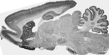 Adult rat brain immunohistochemistry (with antigen retrieval via sodium citrate pretreatment).