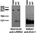 Immunoblot versus crude membranes from adult rat brain (RBM) and wild-type (WT) and LRRK2 KO mouse brains probed with N241A/34 (left) and K89/41 (right) TC supe. Mouse brain samples provided by Xiaojie Li, Ted Dawson and Valina Dawson (Johns Hopkins University).