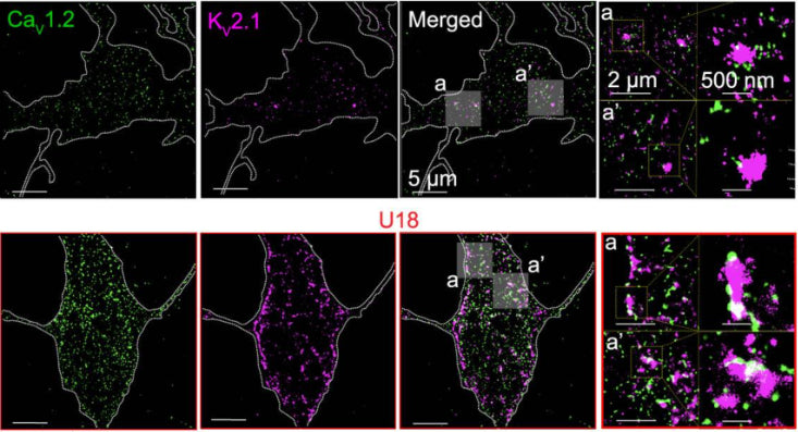 Representative super-resolution TIRF images of CTL (black) and U18-treated (red) neurons co-immunolabeled for CaV1.2 (cat. 75-257, 5ug/ml) and KV2.1 (cat. 75-014, 10ug/ml). Image from publication CC-BY-4.0. PMID:37507375