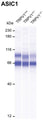 Representative digitally generated blot of ASIC1 (Cat. 75-277, 1:100) in dorsal root ganglion (DRG) tissue isolated from TRPV1+/+, TRPV1+/− and TRPV1−/− rats. For ASIC1 the bands shown at