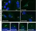 Primary cilium formation in hTERT-RPE1 cells treated with siRNA: control (a), UBQLN4 (b), BAG6 (c), and RNF126 (d). At 72 h after transfection, hTERT-RPE1 cells were serum-starved for 24 h to trigger ciliogenesis, and the distribution of ARL13B, a marker for primary cilia, was observed (Cat. 75-287 green). Control cells grew primary cilia (a), whereas those treated with knockdown of UBQLN4 (b), BAG6 (c), and RNF126 (d)