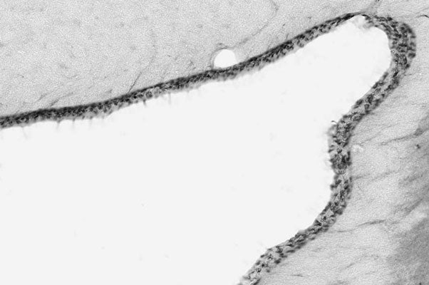 Adult rat brain immunohistochemistry of ciliated cells surrounding the lateral ventricle (LV).