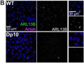 Representative confocal images of WT and Dp10 mouse embryonic fibroblasts. Cells were stained with Hoechst 33342 (blue), the ciliary marker ARL13B (Cat. 75-287, 1:500; green), and Actub (magenta). Image from publication CC-BY-4.0. PMID:36656118