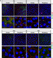 Confocal images from flat mount mouse retina samples at different postnatal ages showing the peripheral or central areas of RPE. ZO-1 staining cell junctions (red), Arl13b is a ciliary marker (Cat. 75-287, 1:2000; green), nuclei (blue). Magnifications of each corresponding image are shown. Image from publication CC-BY-4.0. PMID:37211572