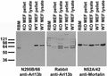 Immunoblot versus crude membranes from adult rat brain (RBM) and pellet/lysate fractions of wild-type (WT) and Arl13b knockout (KO) mouse embryonic fibroblasts (MEF) probed with N295B/66 TC supe (left), rabbit polyclonal (middle) and N52A/42 TC supe (right). MEF cells courtesy of Laura Mariani and Tamara Caspary (Emory University SOM).