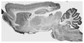 Adult rat brain immunohistochemistry (with antigen retrieval via sodium citrate pretreatment).