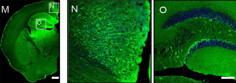Distribution of SHANK3 immuno-positive cells in different regions of the adult mouse cerebral cortex. N, O: High-magnification views of SHANK3-positive cells in the RSPV region (N) and hippocampal region (O) as shown in image M. Green, SHANK3-positive cells (Cat no 75-344, 1:200); blue, cell nuclei. Scale bars, 300 μm (M); 100 μm (N, O). Image from publication, CC-BY-4.0. PMID: 39693031.