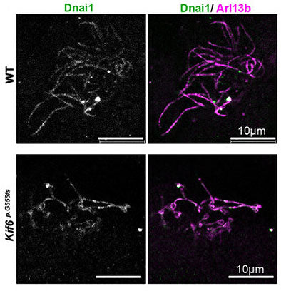 Immunolabeling of mouse WT or Kif6 (p.G555fs) mouse ependymal cells at D14 with labeling Dnai1(Cat no 75-372, green, 1:100, outer dynein arm staining) and Arl13b (magenta, cilia staining). Image from publication, CC-BY-4.0. PMID: 38235522.