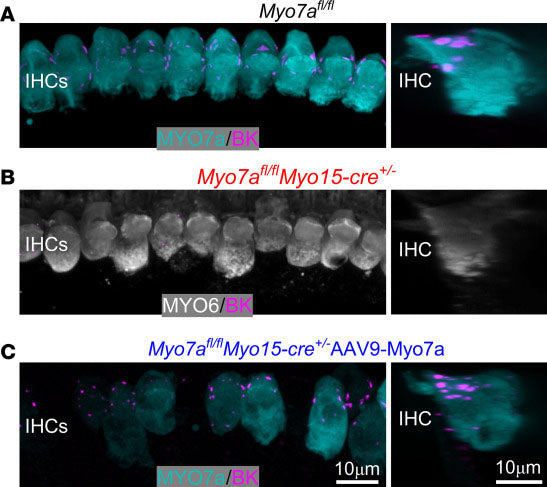 Confocal Z stack images taken from the 9–12 kHz cochlear region in noninjected control Myo7afl/fl (A), Myo7afl/fl Myo15-cre+/– (B), and Myo7afl/fl Myo15-cre+/– mice injected with AAV9-Myo7a (C) at P49–P54. AAV-Myo7a was injected between P13 and P15. Cochleae were labeled with antibodies against BK (Cat no 75-408, 1:200, magenta) and the IHC markers MYO7A (cyan) or MYO6 (gray). BK was almost complete absence in Myo7afl/fl Myo15-cre+/– mice (B). Image from publication, CC-BY-4.0. PMID: 39641274