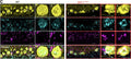 Representative maximum intensity projections from WT (black) and NPC1I1061T (red) mouse cerebellar sagittal sections co-immunolabeled for Calbindin (Cat. 75-448, 2ug/ml) , CaV1.2 (Cat. 75-257, 5ug/ml) and KV2.1 (Cat. 75-014, 10ug/ml). Image from publication CC-BY-4.0. PMID:37507375
