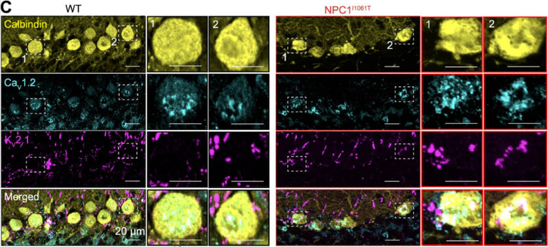 Representative maximum intensity projections from WT (black) and NPC1I1061T (red) mouse cerebellar sagittal sections co-immunolabeled for Calbindin(cat. 75-448, 2ug/ml) , CaV1.2 (cat. 75-257, 5ug/ml) and KV2.1 (cat. 75-014, 10ug/ml). Image from publication CC-BY-4.0. PMID:37507375