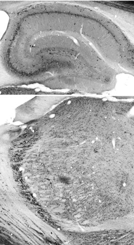 Adult rat hippocampus (top) and
thalamus (bottom) immunohistochemistry