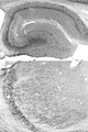 Adult rat hippocampus (top) and thalamus (bottom) immunohistochemistry