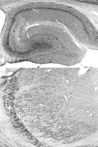 Adult rat hippocampus (top) and thalamus (bottom) immunohistochemistry