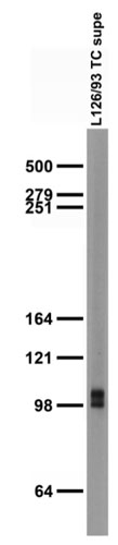 Adult rat brain membrane immunoblot