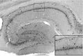 Adult rat hippocampus immunohistochemistry with inset showing higher magnification labeling of CA1 interneurons (dashed box)