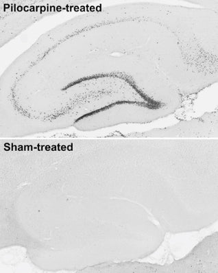 Immunohistochemistry against hippocampus from adult rats treated with pilocarpine to induce seizures (top) and with saline (bottom).
