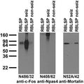 Immunoblot against crude brain low-speed pellets from untreated adult rats (RBLSP), adult rats treated with kainic acid to induce seizures (RBLSP seiz) and adult rats treated with saline (RBLSP non-seiz) probed with N486/32 (left), N408/62 (middle) and N52A/42 (right) TC supe.