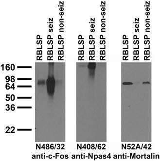 Immunoblot against crude brain low-speed pellets from untreated adult rats (RBLSP), adult rats treated with kainic acid to induce seizures (RBLSP seiz) and adult rats treated with saline (RBLSP non-seiz) probed with N486/32 (left), N408/62 (middle) and N52A/42 (right) TC supe.