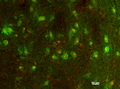 Double-labeled fluorescence immunohistochemistry of human midbrain dopamine neurons stained green with LNC1 and red with PitX.
