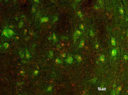 Double-labeled fluorescence immunohistochemistry of human midbrain dopamine neurons stained green with LNC1 and red with PitX.