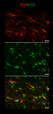 Mouse brain midbrain dopamine neurons in the substantia nigra double-labeled with LNC1 for tyrosine hydroxylase (TH, red and cytoplasmic) and a rabbit antibody to Nuclear Factor Y subunit A (NFYA, green and primarily nuclear).