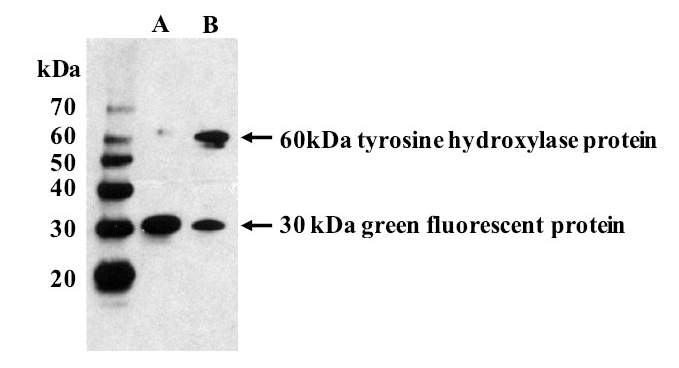 Western Blot of HEK293 cells transfected to express human Tyrosine Hydroxylase isoform 2 and Green Fluorescent Protein demonstrates the specificity of mouse monoclonal antibody LNC1 to tyrosine hydroxylase protein.