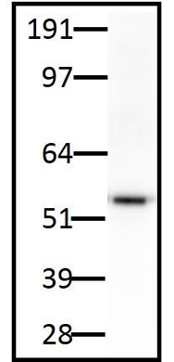 LNC1 anti-TH monoclonal antibody was used at 2.5ug/mL to stain endogenous tyrosine hydroxylase in rat brain lysate.